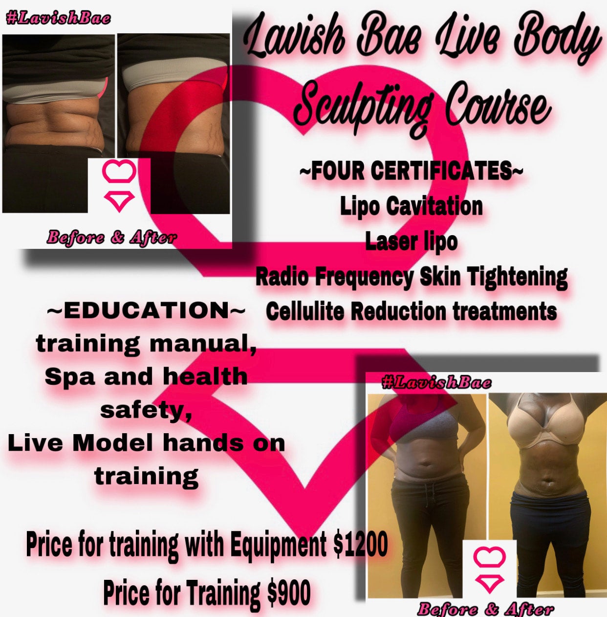 Laser Body Sculpting Pricing, Body Sculpting Prices
